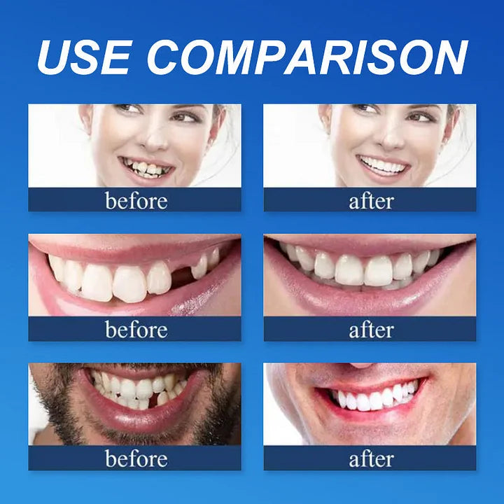 🏆Ends Today: 70% OFF! 🏆2026 Bestselling Product🦷 Fit for a Fresh Smile, Say Goodbye to Wearing Discomfort!🌎